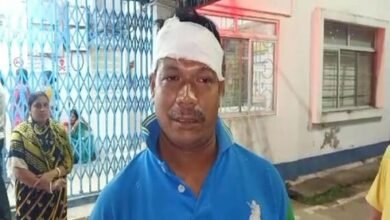 Photo of नेता के हमले में लहूलुहान 1