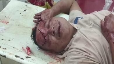 Photo of स्कूटी दुर्घटना में टीएसआर का जवान गंभीर रूप से घायल हो गया