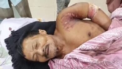 Photo of बाढ़ के हाथियों द्वारा खदेड़े जाने से एक किसान गंभीर रूप से घायल हो गया