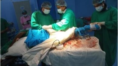 Photo of धलाई जिला अस्पताल में पहली बार, दुर्लभ हड्डी की सर्जरी के लिए सी-आर्म मशीन