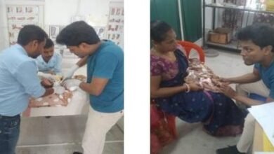 Photo of बिलोनिया उप-विभागीय अस्पताल में क्लबफुट क्लिनिक